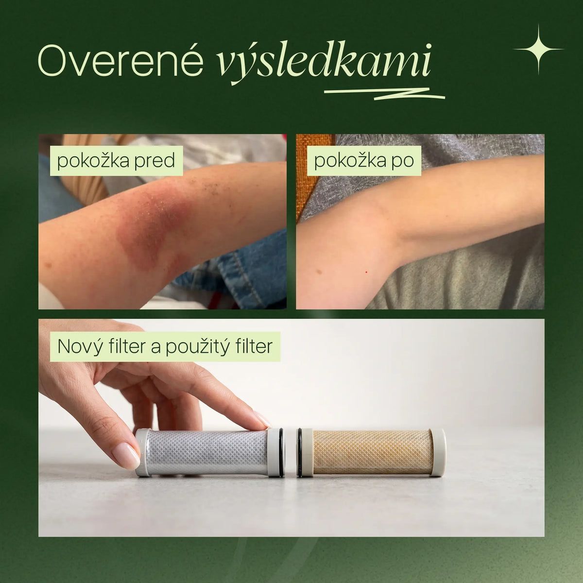 Zenea Filtračná sprchová hlavica