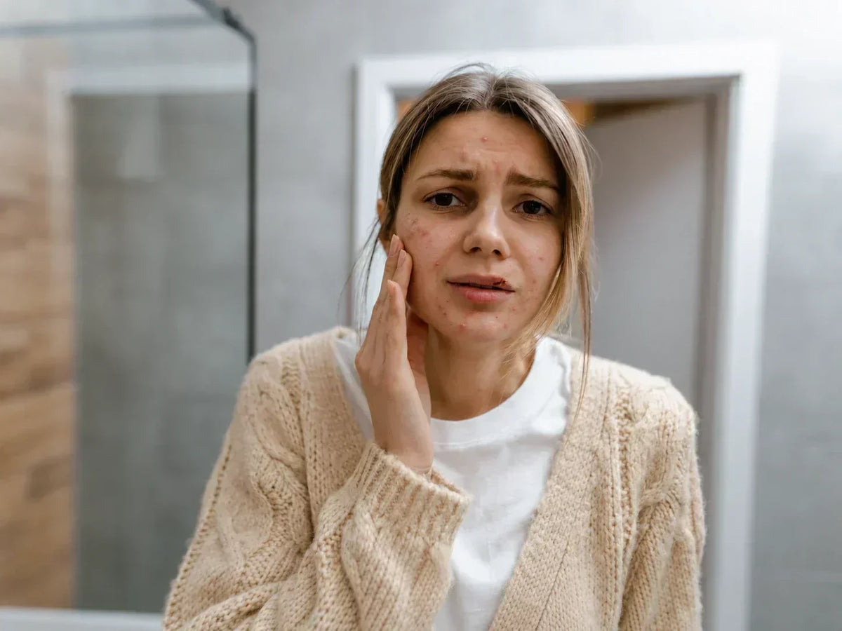 zena-s-problematickou-pletou-a-drobnymi-vyrazkami-v-kupelni