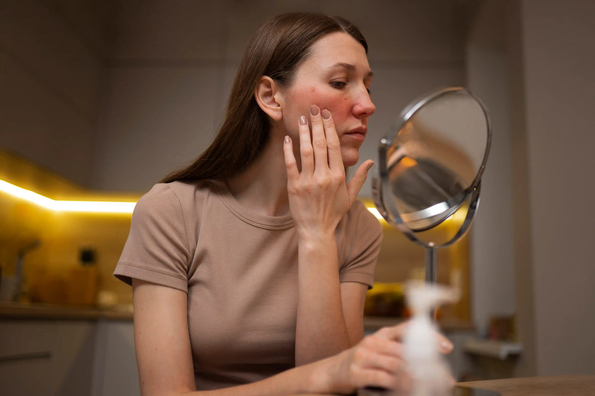 Rosacea a každodenné spúšťače, ktoré ju môžu zhoršovať