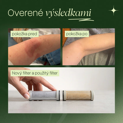 Zenea Filtračná sprchová hlavica